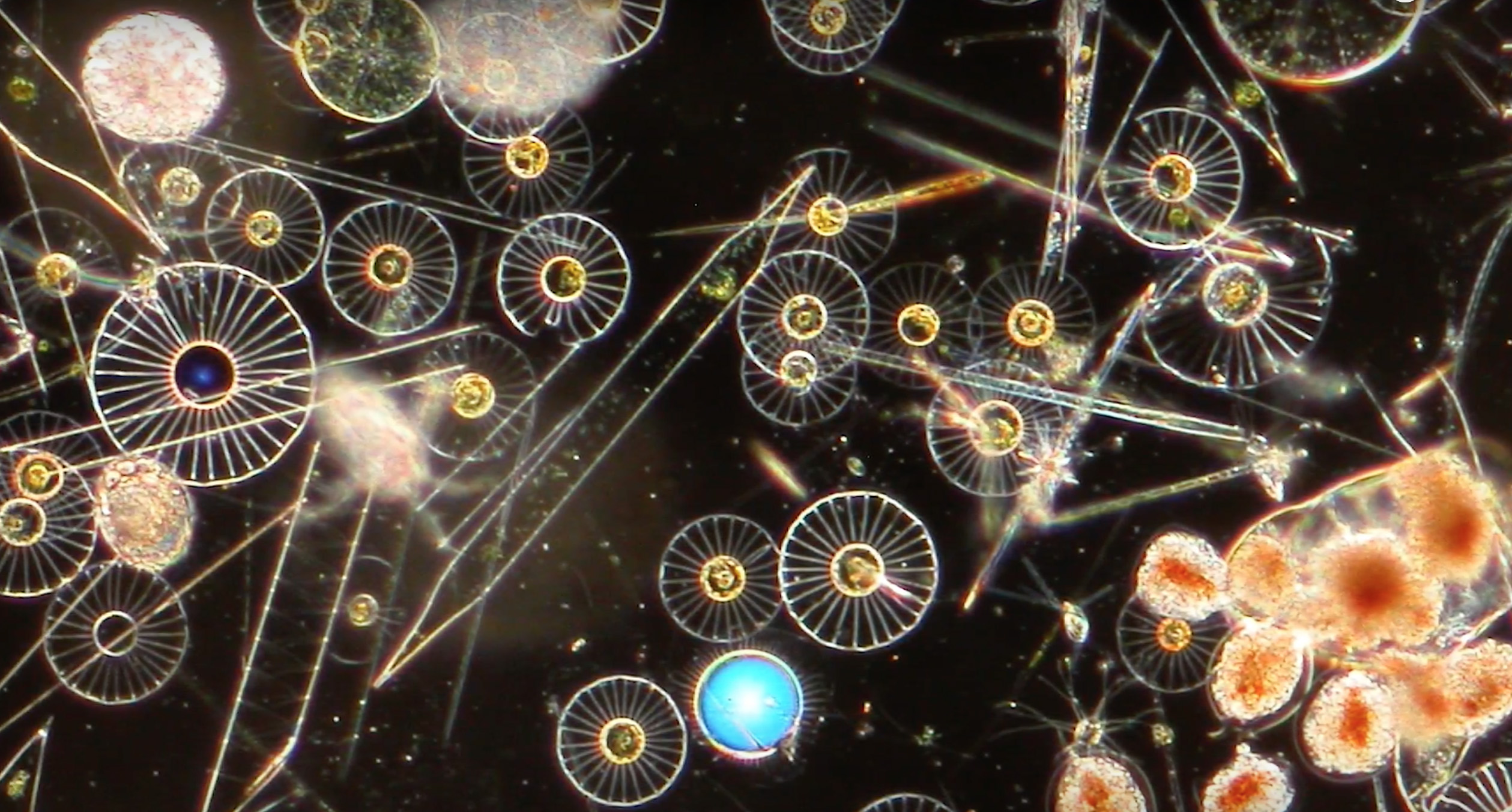 Фитопланктон уровень. Сапробность фитопланктон. Фитопланктон под микроскопом. Планктон под микроскопом. Диатомовый планктон под микроскопом.
