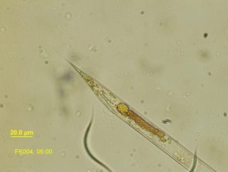 Rhizosolenia in a symbiotic relationship with Richelia