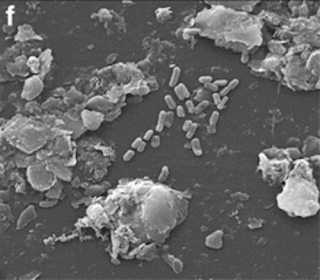 Bacterial cells (~1.5 mmlong) attached to polyethylene microplastics in U.K. coastal marine sediments. 