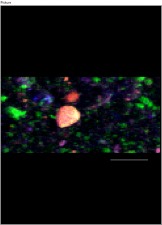 Xray Fluorescence map of particles from Synchrotron. Iron (Fe) is red, Calcium (Ca) is green, and Zinc (Zn) is blue.